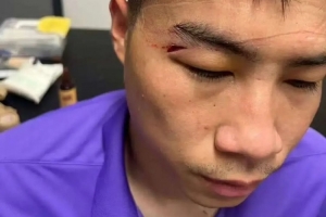 津媒:王献钧两颗门牙被撞断,杨帆眉骨受伤赛后去医院缝针 津媒:王献钧两颗门牙被撞断,杨帆眉骨受伤赛后去医院缝针