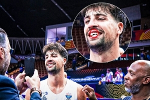 磕掉半颗大门牙!阿夫迪亚率队拿首胜:一切都值得! 磕掉半颗大门牙!阿夫迪亚率队拿首胜:一切都值得!