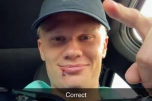 撞破下巴缝3针,哈兰德与球迷互动:被厄德高打的?没错😂 撞破下巴缝3针,哈兰德与球迷互动:被厄德高打的?没错😂