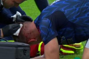 加布里埃尔争顶时把约克雷斯头撞出血,后者缠绷带后继续比赛 加布里埃尔争顶时把约克雷斯头撞出血,后者缠绷带后继续比赛