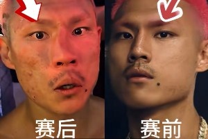 惨遭“整容”!恶鼠遭威姆斯TKO 鼻梁骨被打歪鲜血直流🤕 惨遭“整容”!恶鼠遭威姆斯TKO 鼻梁骨被打歪鲜血直流🤕