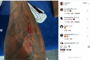 踢满全场+客串中卫!里斯-詹姆斯社媒晒腿上伤口 踢满全场+客串中卫!里斯-詹姆斯社媒晒腿上伤口