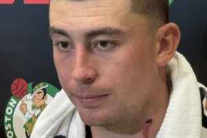 颈部有明显血痕!普理查德:训练营里的对抗像打仗一样 颈部有明显血痕!普理查德:训练营里的对抗像打仗一样