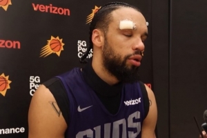 是谁干的?狄龙:训练中被队友用肘部撞到了额头 我缝了六针 是谁干的?狄龙:训练中被队友用肘部撞到了额头 我缝了六针