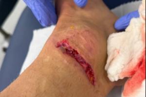 慎入!迪涅脚踝被踩而裁判无表示,换下后怒踢座椅找四官泰勒理论 慎入!迪涅脚踝被踩而裁判无表示,换下后怒踢座椅找四官泰勒理论